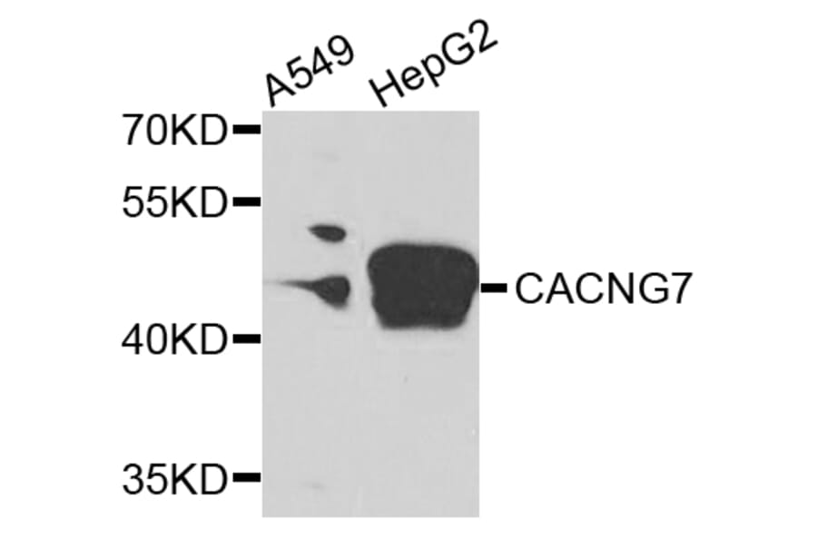 Western Blot - Anti-CACNG7 Antibody (A7989) - Antibodies.com