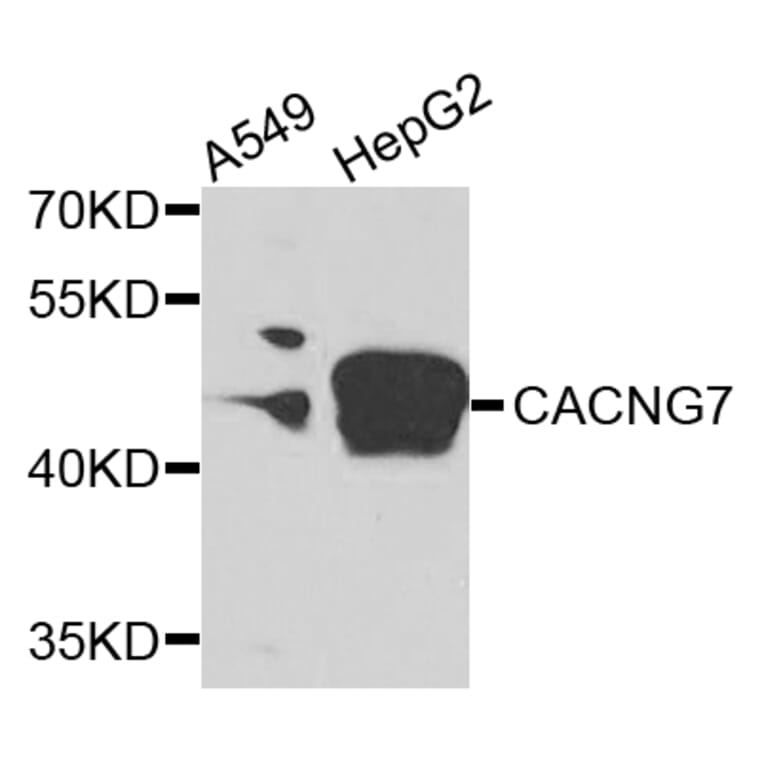 Western Blot - Anti-CACNG7 Antibody (A7989) - Antibodies.com