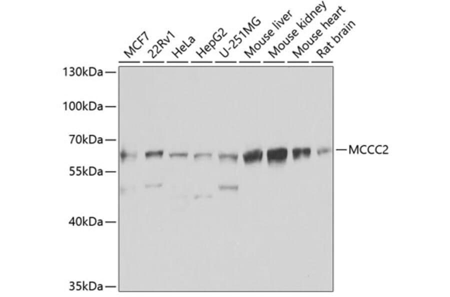 Western Blot - Anti-MCCC2 Antibody (A7990) - Antibodies.com
