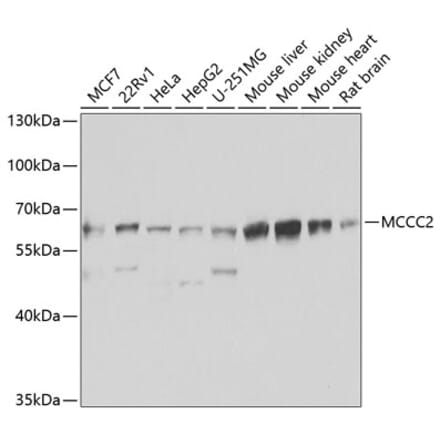 Western Blot - Anti-MCCC2 Antibody (A16027) - Antibodies.com