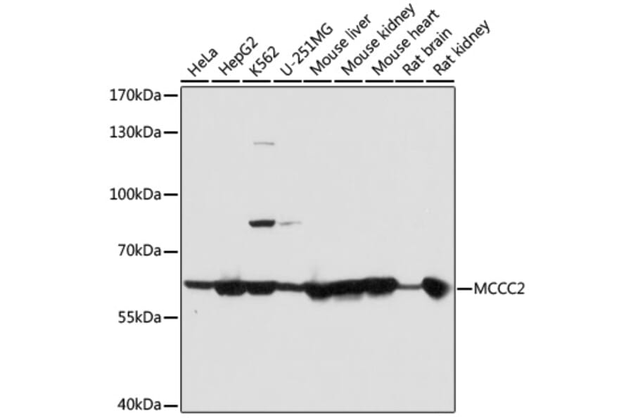Western Blot - Anti-MCCC2 Antibody (A7990) - Antibodies.com