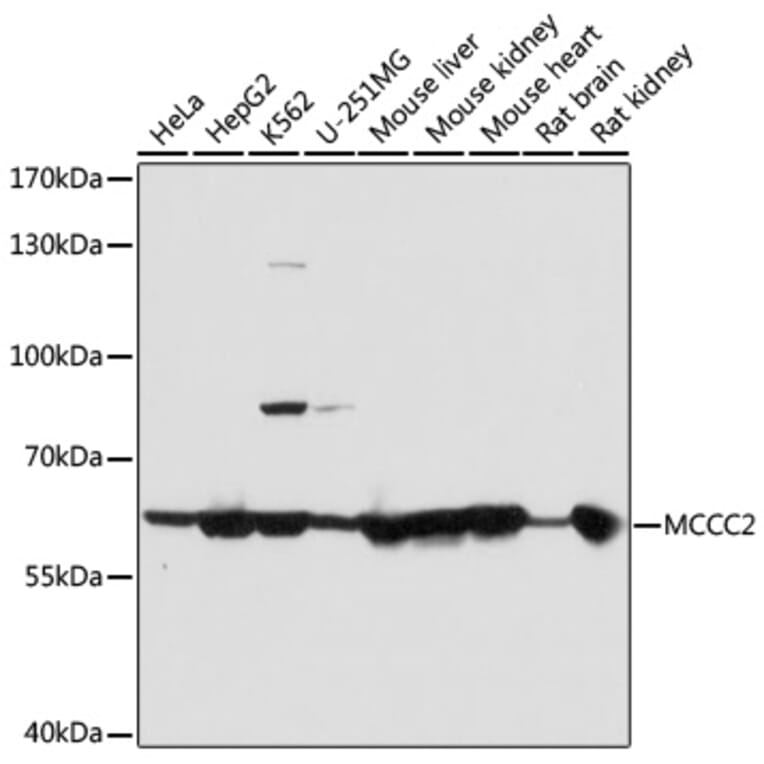 Western Blot - Anti-MCCC2 Antibody (A7990) - Antibodies.com