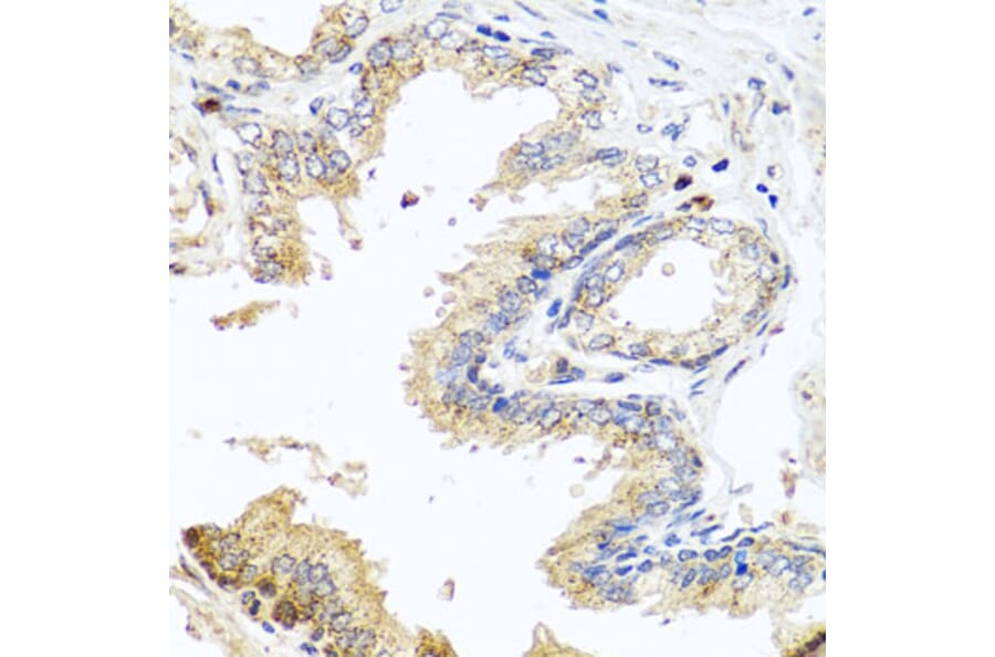 Immunohistochemistry - Anti-MCCC2 Antibody (A7990) - Antibodies.com