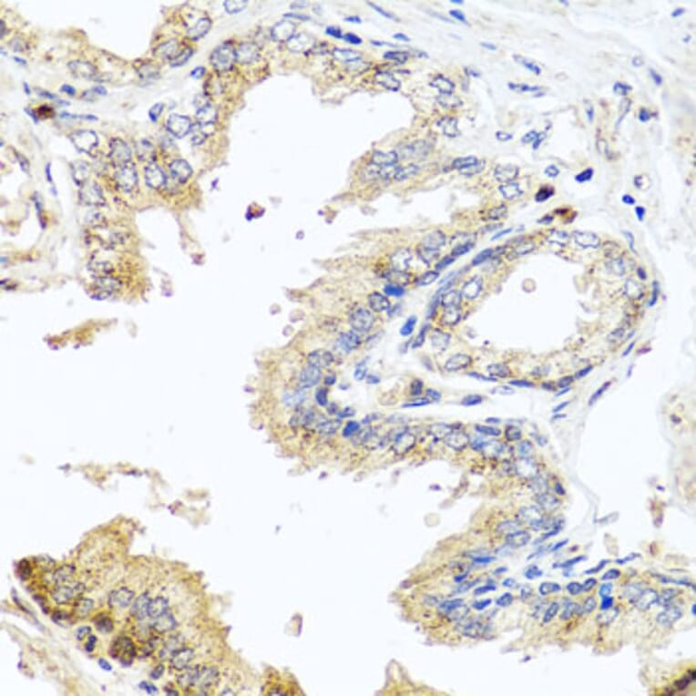 Immunohistochemistry - Anti-MCCC2 Antibody (A7990) - Antibodies.com