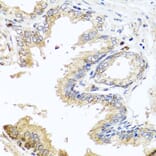 Immunohistochemistry - Anti-MCCC2 Antibody (A7990) - Antibodies.com