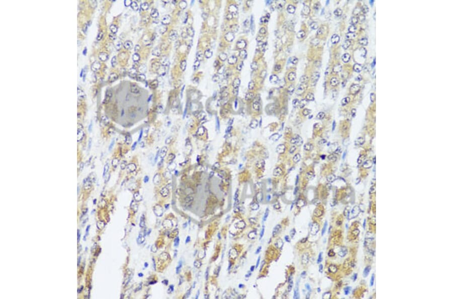 Immunohistochemistry - Anti-MCCC2 Antibody (A7990) - Antibodies.com