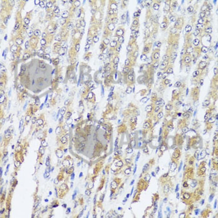 Immunohistochemistry - Anti-MCCC2 Antibody (A7990) - Antibodies.com