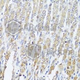 Immunohistochemistry - Anti-MCCC2 Antibody (A7990) - Antibodies.com