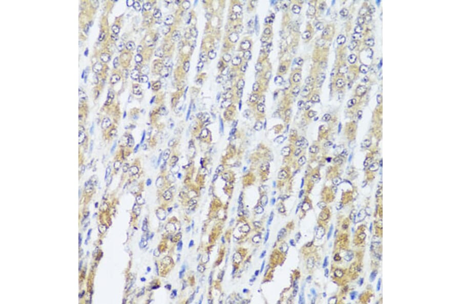 Immunohistochemistry - Anti-MCCC2 Antibody (A7990) - Antibodies.com