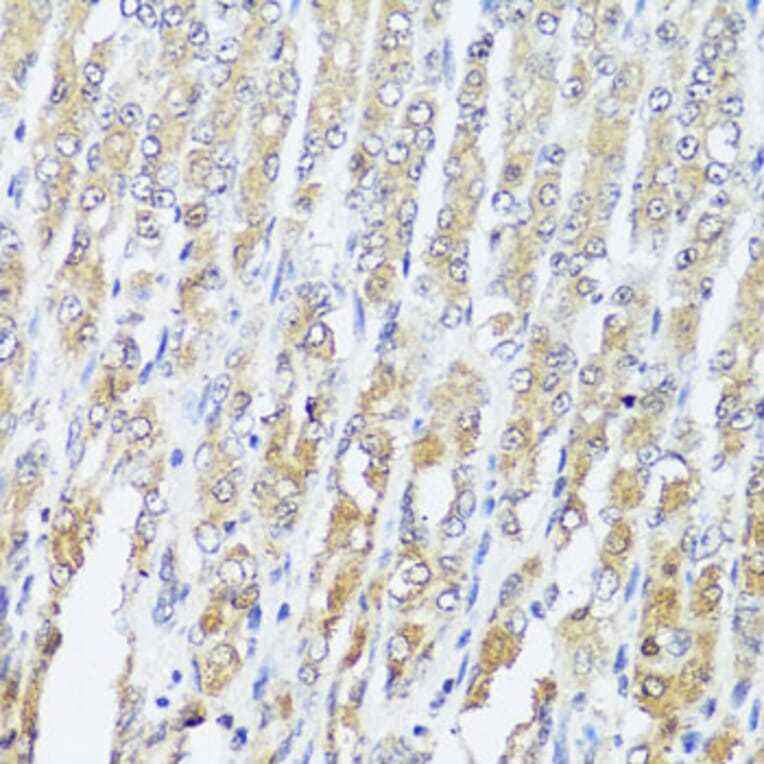 Immunohistochemistry - Anti-MCCC2 Antibody (A7990) - Antibodies.com
