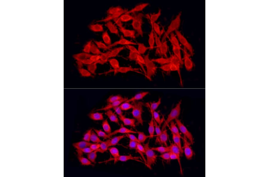 Immunofluorescence - Anti-JMJD4 Antibody (A16028) - Antibodies.com