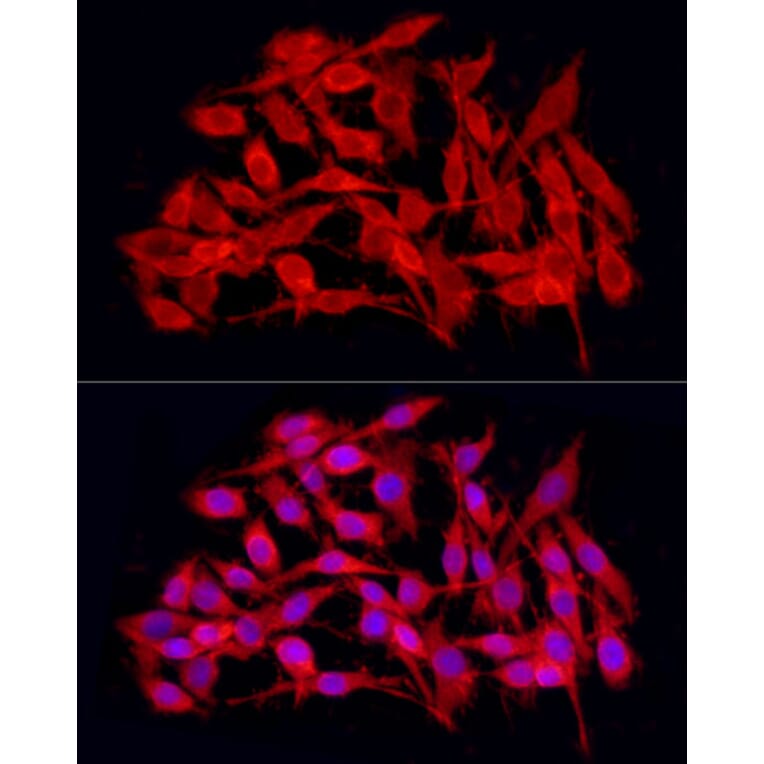 Immunofluorescence - Anti-JMJD4 Antibody (A16028) - Antibodies.com