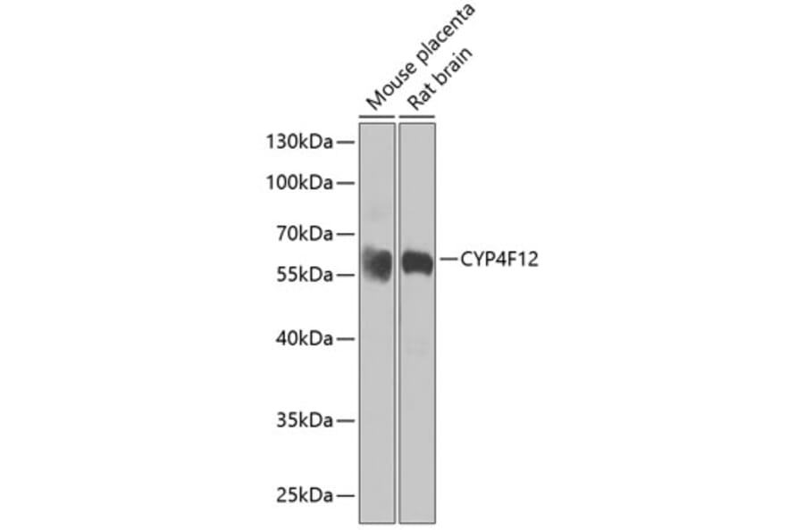 Western Blot - Anti-CYP4F12 Antibody (A16029) - Antibodies.com