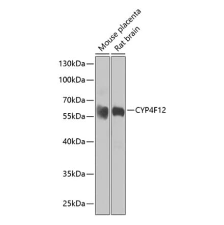 Western Blot - Anti-CYP4F12 Antibody (A16029) - Antibodies.com