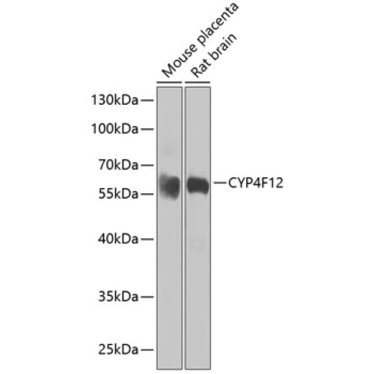 Western Blot - Anti-CYP4F12 Antibody (A16029) - Antibodies.com