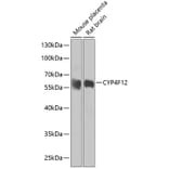 Western Blot - Anti-CYP4F12 Antibody (A16029) - Antibodies.com