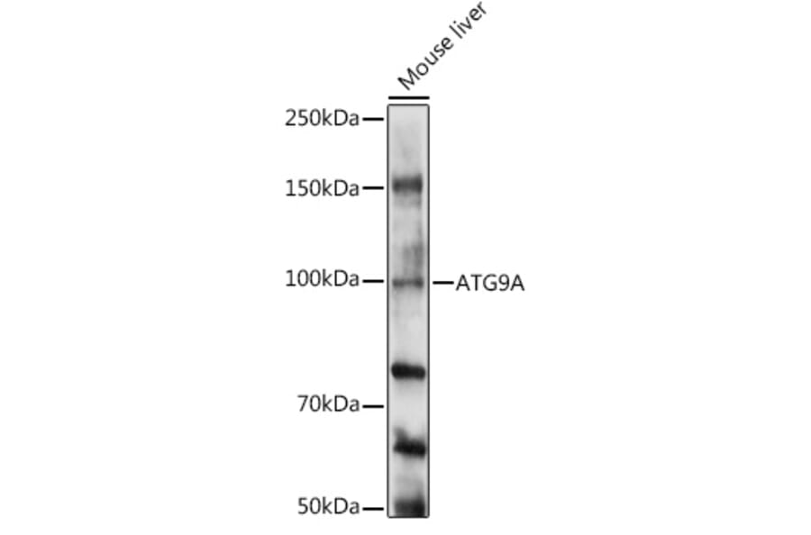 Western Blot - Anti-ATG9A Antibody (A16030) - Antibodies.com