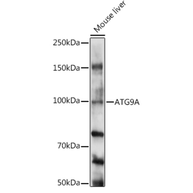 Western Blot - Anti-ATG9A Antibody (A16030) - Antibodies.com