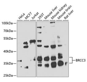 Western Blot - Anti-BRCC36 Antibody (A16031) - Antibodies.com