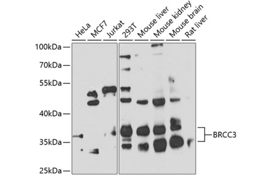 Western Blot - Anti-BRCC36 Antibody (A16031) - Antibodies.com