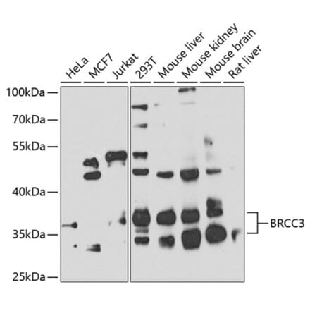 Western Blot - Anti-BRCC36 Antibody (A16031) - Antibodies.com