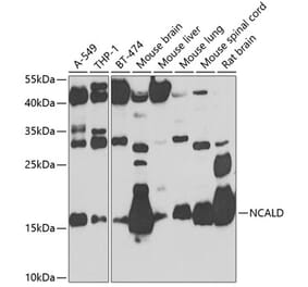 Western Blot - Anti-NCALD Antibody (A16033) - Antibodies.com