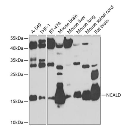 Western Blot - Anti-NCALD Antibody (A16033) - Antibodies.com