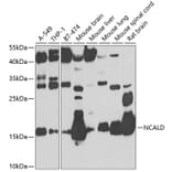 Western Blot - Anti-NCALD Antibody (A16033) - Antibodies.com