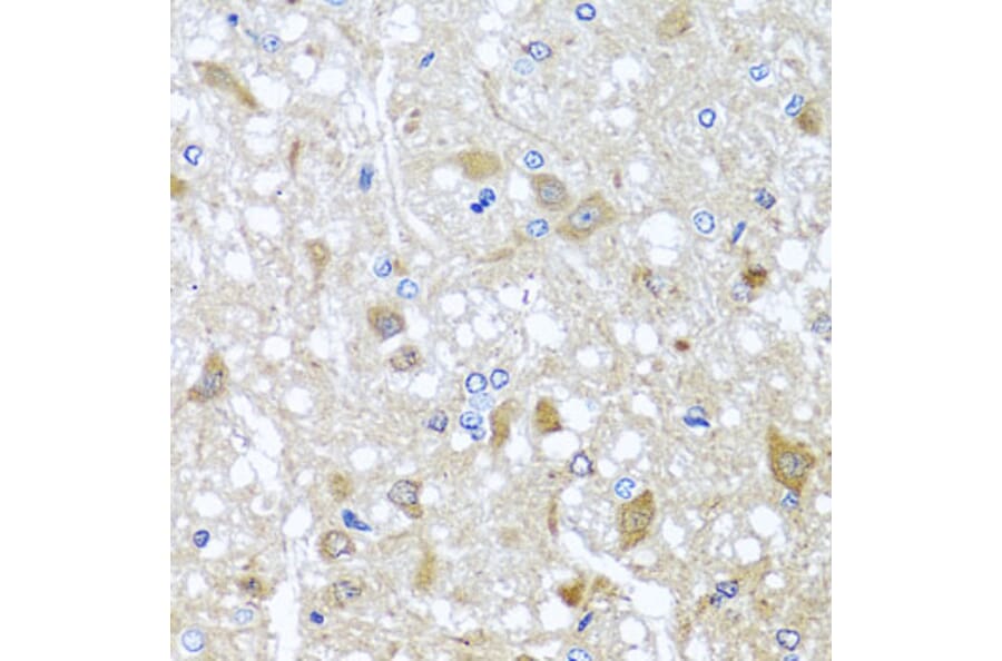 Immunohistochemistry - Anti-EFHC1 Antibody (A8002) - Antibodies.com
