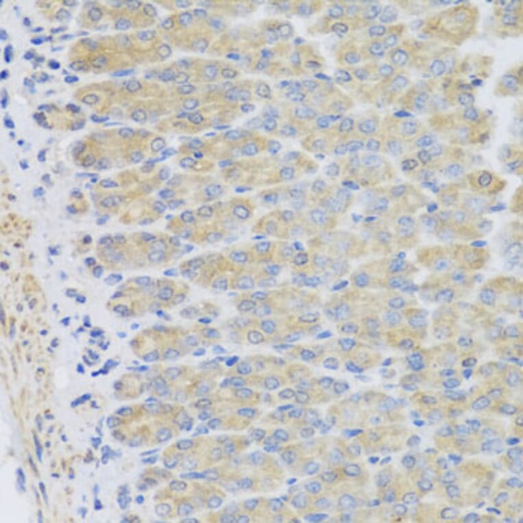 Immunohistochemistry - Anti-EFHC1 Antibody (A8002) - Antibodies.com