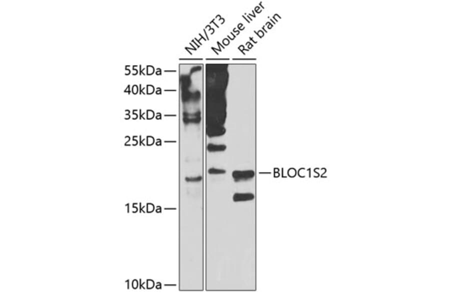 Western Blot - Anti-CEAP Antibody (A16035) - Antibodies.com