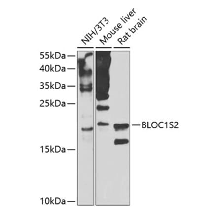 Western Blot - Anti-CEAP Antibody (A16035) - Antibodies.com