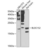 Western Blot - Anti-CEAP Antibody (A16035) - Antibodies.com
