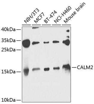 Western blot analysis of extracts of various cell lines, using Anti-CALM2 Antibody (A8008) at 1:1,000 dilution. Secondary antibody: Goat Anti-Rabbit IgG (H+L) (HRP) (AS014) at 1:10,000 dilution. Lysates / proteins: 25µg per lane. Blocking buffer: 3% non-fat dry milk in TBST. Detection: ECL Basic Kit (RM00020). Exposure time: 30s.