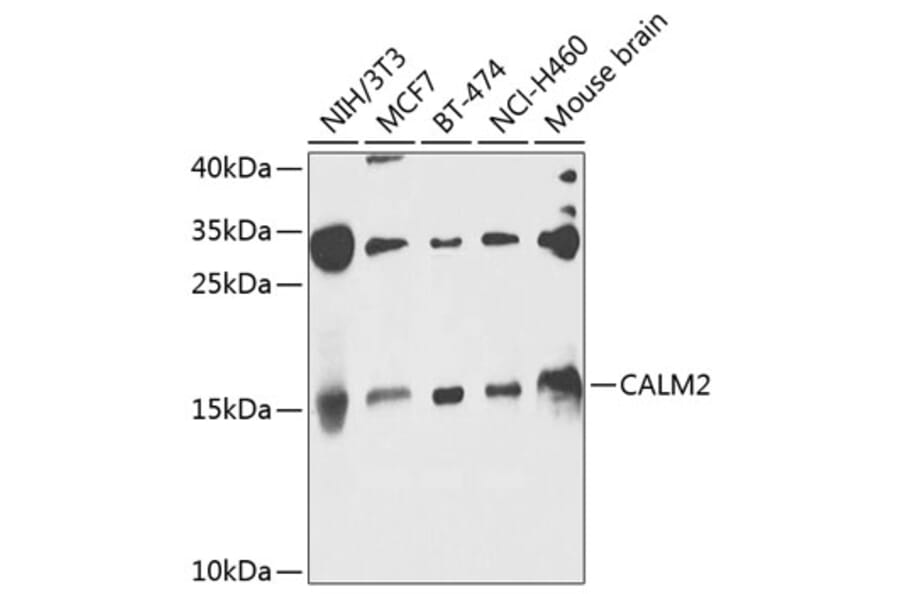 Western Blot - Anti-Calmodulin 1/2/3 Antibody (A16036) - Antibodies.com