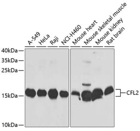 Western Blot - Anti-Cofilin 2 Antibody (A16037) - Antibodies.com