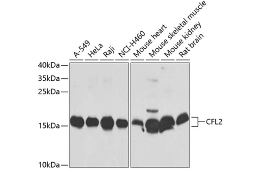 Western Blot - Anti-Cofilin 2 Antibody (A16037) - Antibodies.com