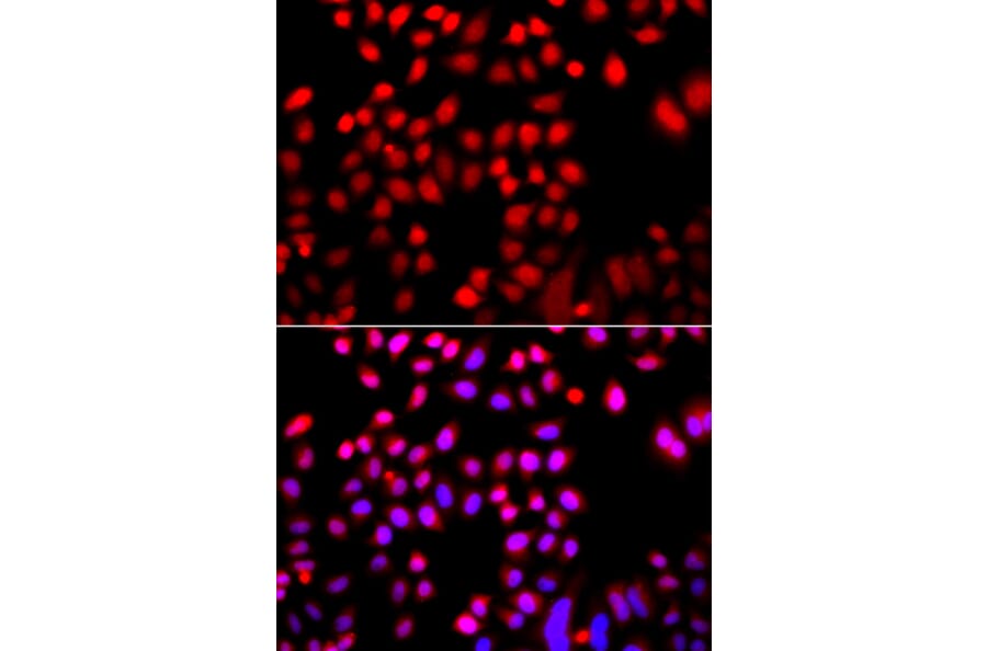 Immunofluorescence - Anti-Cofilin 2 Antibody (A16037) - Antibodies.com