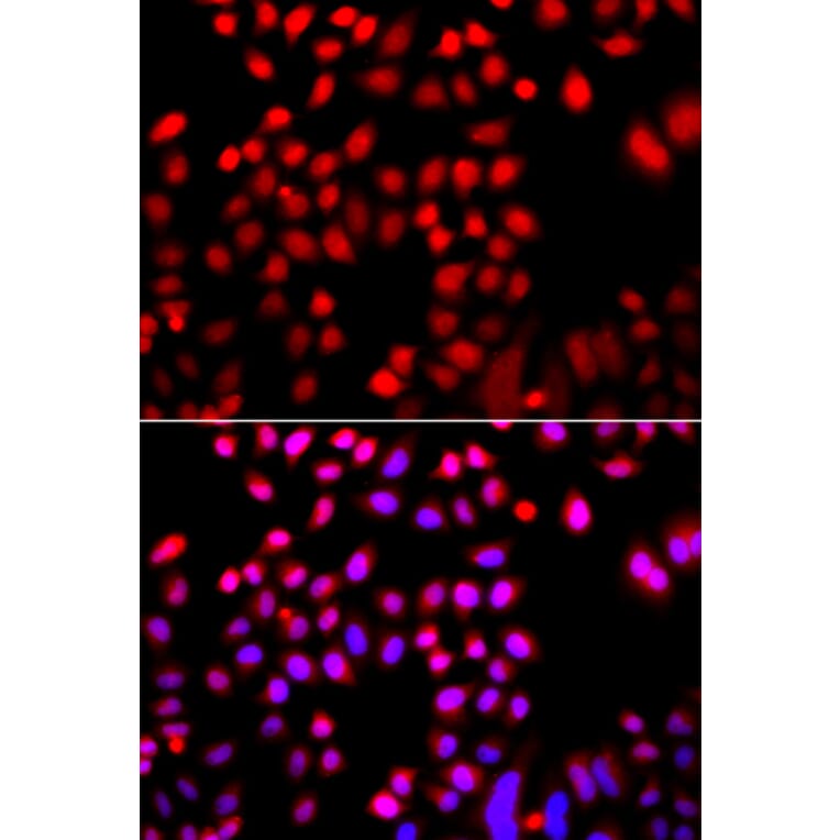 Immunofluorescence - Anti-Cofilin 2 Antibody (A16037) - Antibodies.com