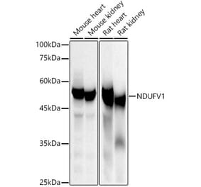 Western Blot - Anti-NDUFV1 Antibody (A16038) - Antibodies.com