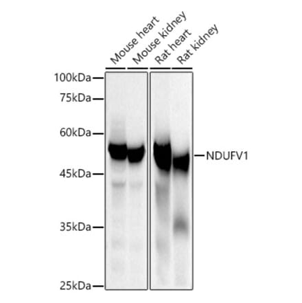 Western Blot - Anti-NDUFV1 Antibody (A16038) - Antibodies.com