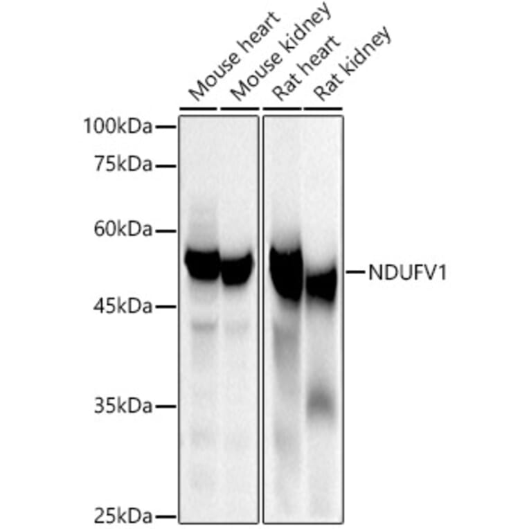 Western Blot - Anti-NDUFV1 Antibody (A16038) - Antibodies.com