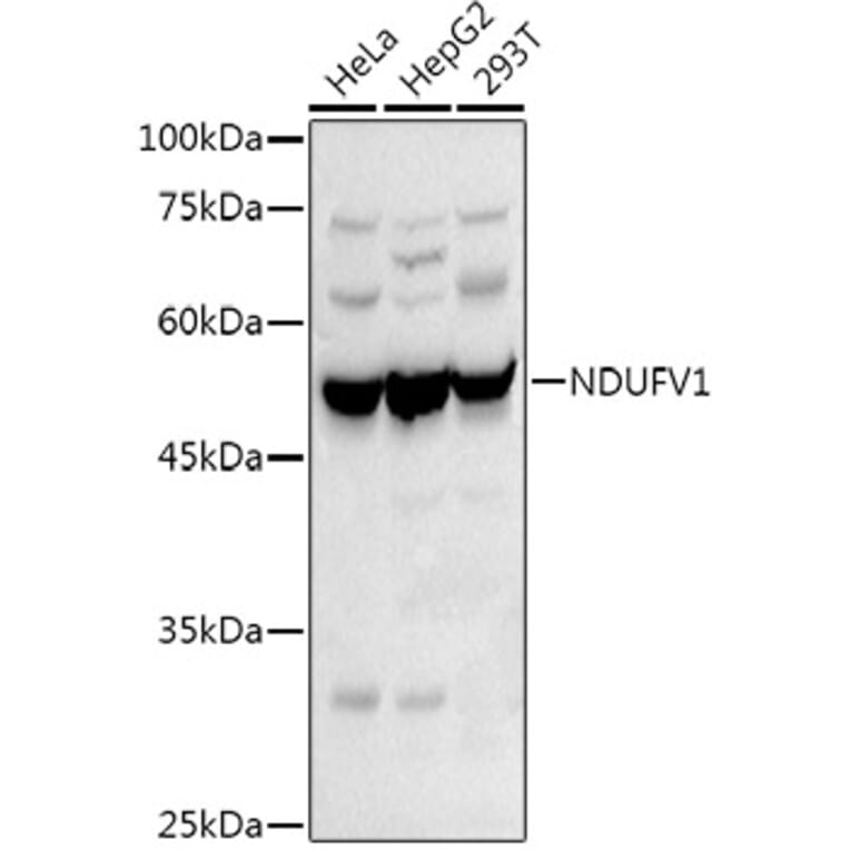 Western Blot - Anti-NDUFV1 Antibody (A16038) - Antibodies.com