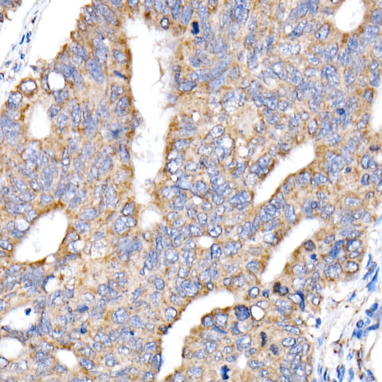 Immunohistochemistry - Anti-NDUFV1 Antibody (A16038) - Antibodies.com