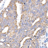 Immunohistochemistry - Anti-NDUFV1 Antibody (A16038) - Antibodies.com