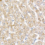 Immunohistochemistry - Anti-NDUFV1 Antibody (A16038) - Antibodies.com