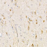 Immunohistochemistry - Anti-NDUFV1 Antibody (A16038) - Antibodies.com