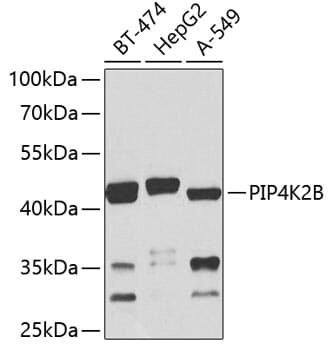 Western blot analysis of extracts of various cell lines, using Anti-PIP4K2B Antibody (A8016) at 1:1,000 dilution.
Secondary antibody: Goat Anti-Rabbit IgG (H+L) (HRP) (AS014) at 1:10,000 dilution.
Lysates / proteins: 25µg per lane.
Blocking buffer: 3% non-fat dry milk in TBST.
Detection: ECL Basic Kit (RM00020).
Exposure time: 30s.