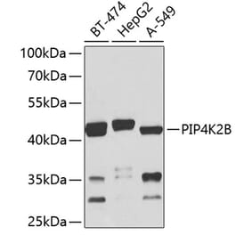 Western Blot - Anti-PIP4K2 beta Antibody (A16039) - Antibodies.com