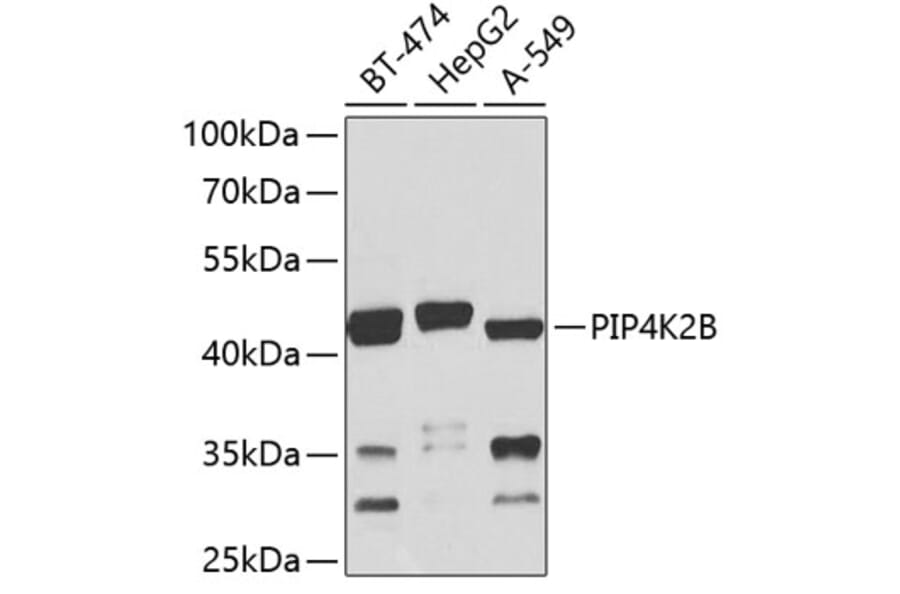 Western Blot - Anti-PIP4K2 beta Antibody (A16039) - Antibodies.com